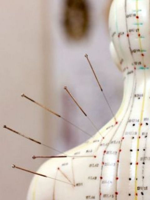 Рефлексотерапия